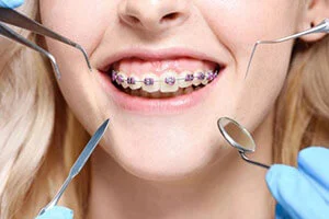 orthodontic services in istanbul